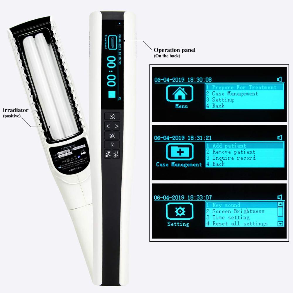 UVB Phototherapy